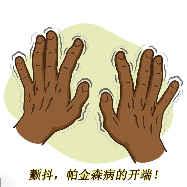 顫抖，帕金森病的開(kāi)端 帕金森的早期癥狀