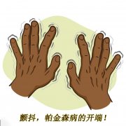 顫抖，帕金森病的開端 帕金森的癥狀有哪些